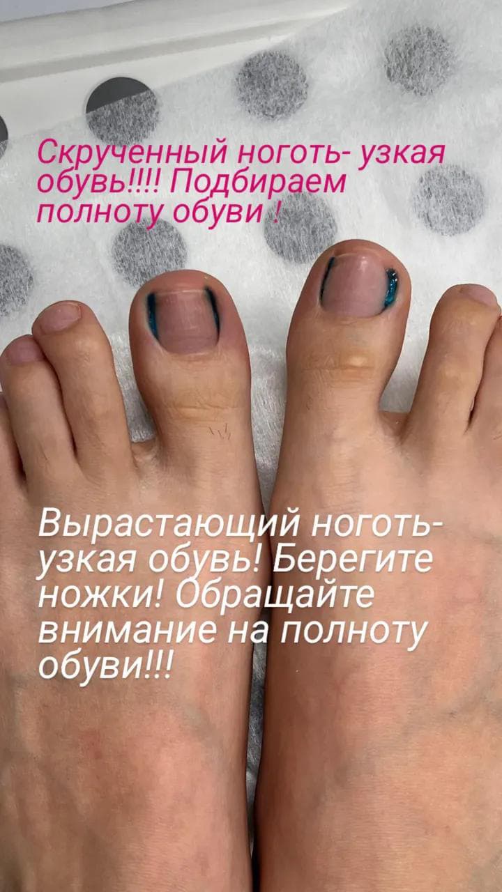 Декабрьская акция